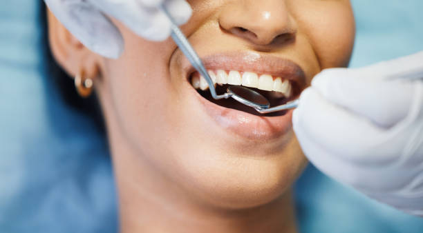 Best Chipped Tooth Repair Near Me  in Genesee, ID